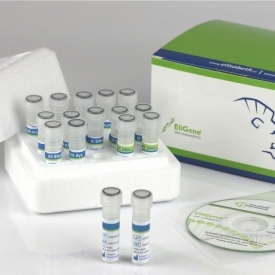 EliGene® COVID19 BASIC A RT kit